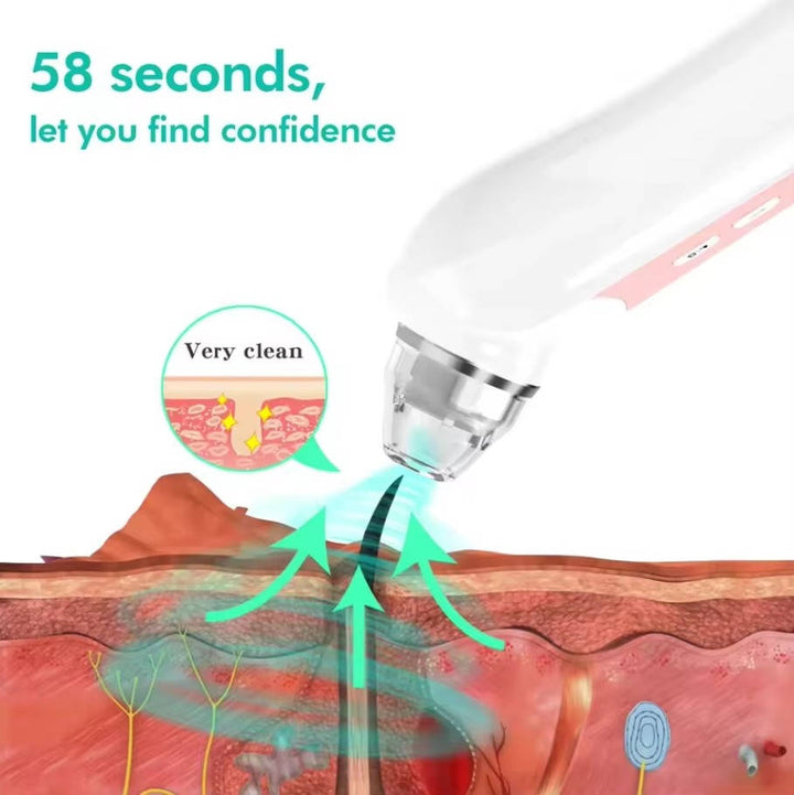 Blackhead Remover Vacuum with Camera USB Interface Pore