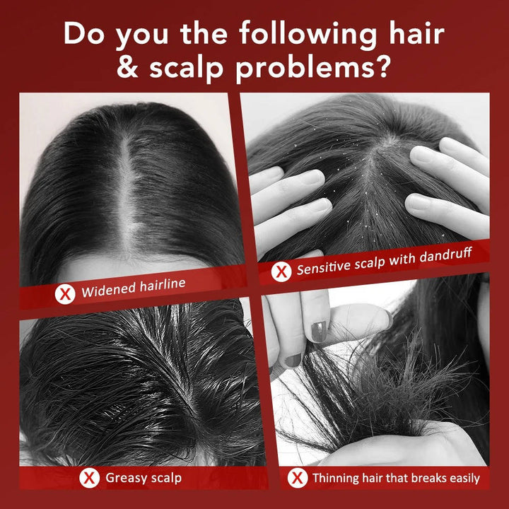 Scalp Massager Brush for Hair Growth Stimulation