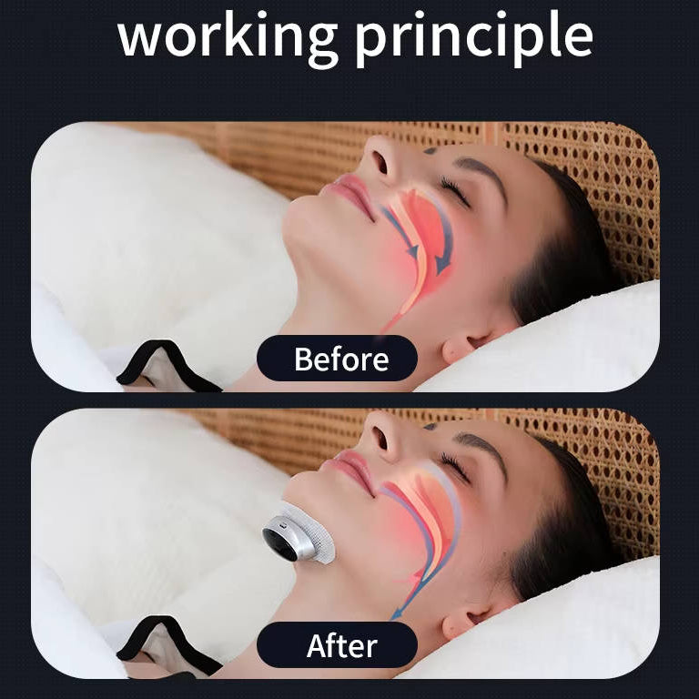 Anti-Snoring Sleep Apnea Aid Device Adjustable