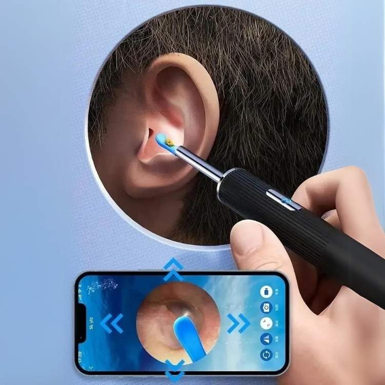 Wireless Ear Wax Removal Camera with LED and Rechargeable Handle - Lenila