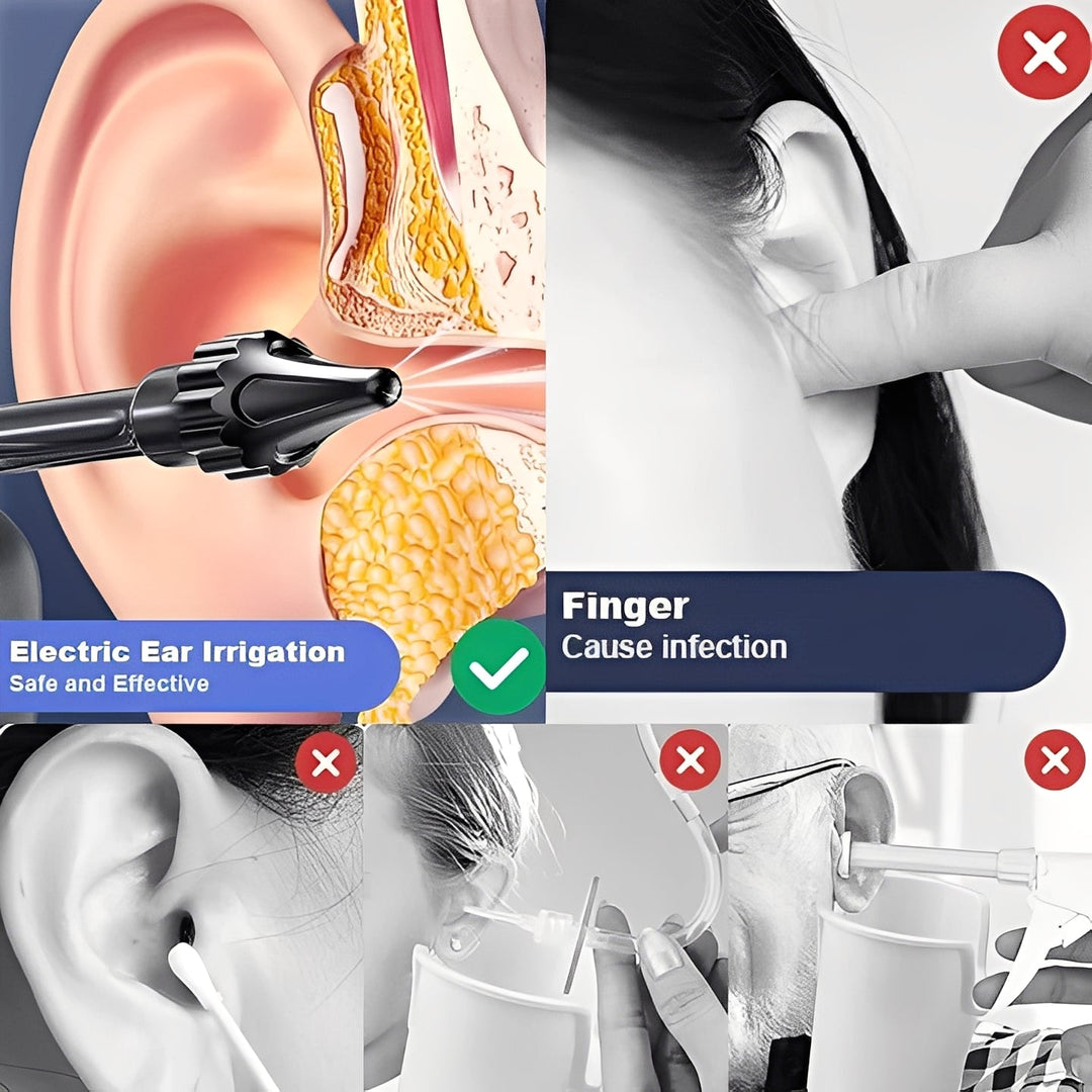 Water-Based Ear Cleaning System with Soft Tip