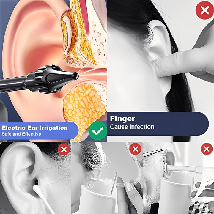 Water-Based Ear Cleaning System with Soft Tip
