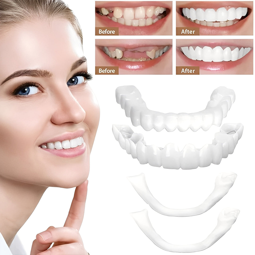 Cosmetic Dental Veneers Natural Finish