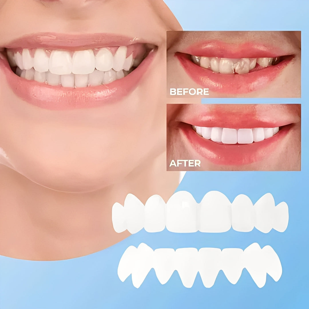 Cosmetic Dental Veneers Natural Finish