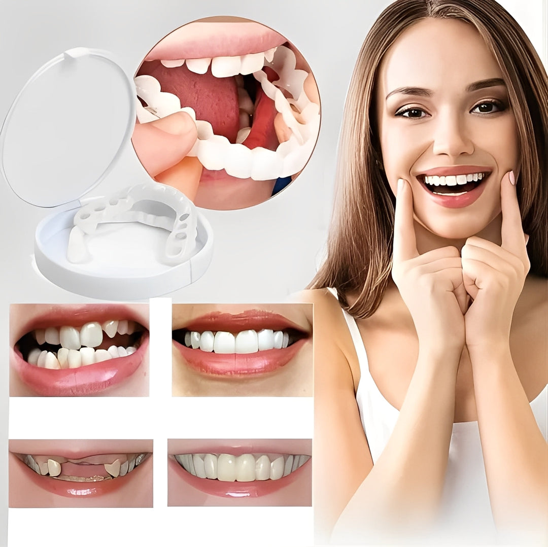 Cosmetic Dental Veneers Natural Finish