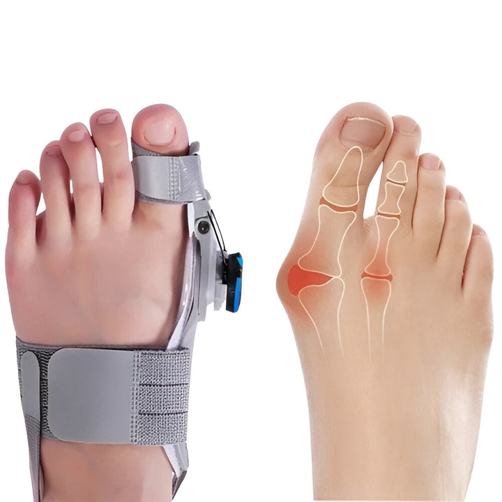 Ergonomic Toe Spacer Silicone Bunion Support Adjustable Fit - Lenila