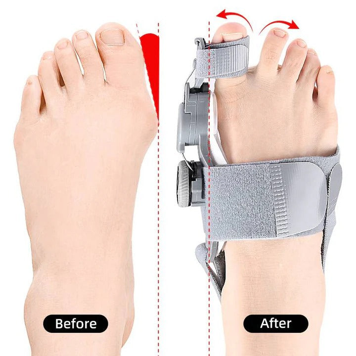 Ergonomic Toe Spacer Silicone Bunion Support Adjustable Fit