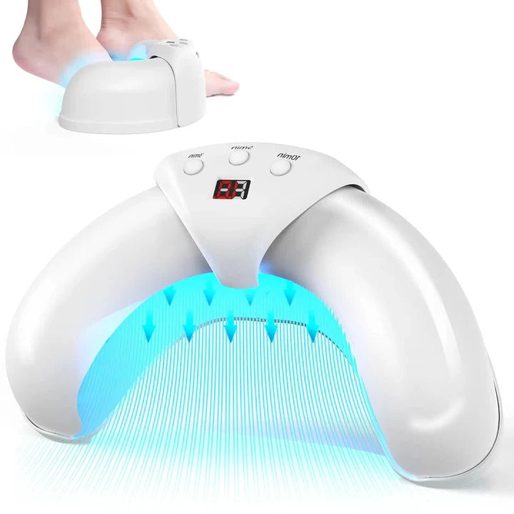 Nail Fungus Treatment Laser Device - Lenila