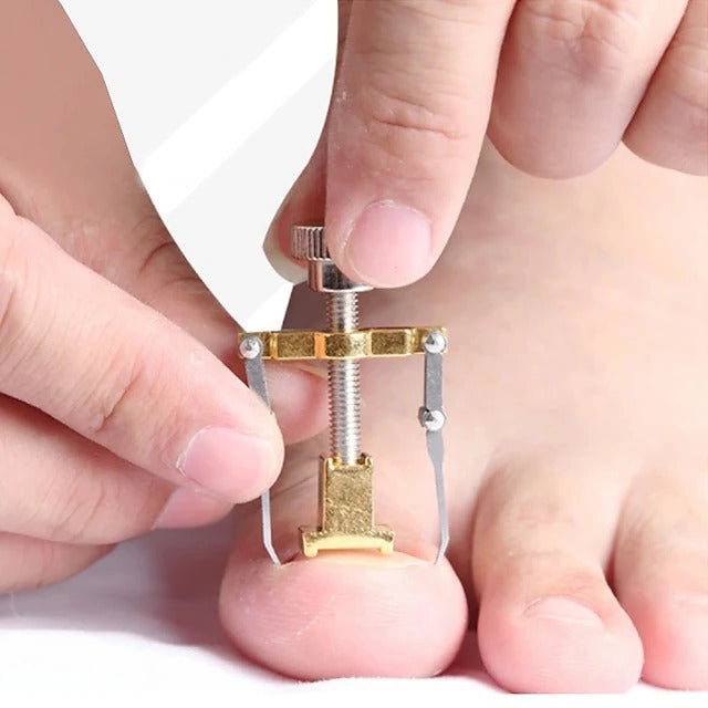 Ingrown Toenail Corrector Tool Stainless Steel Pedicure Care - Lenila