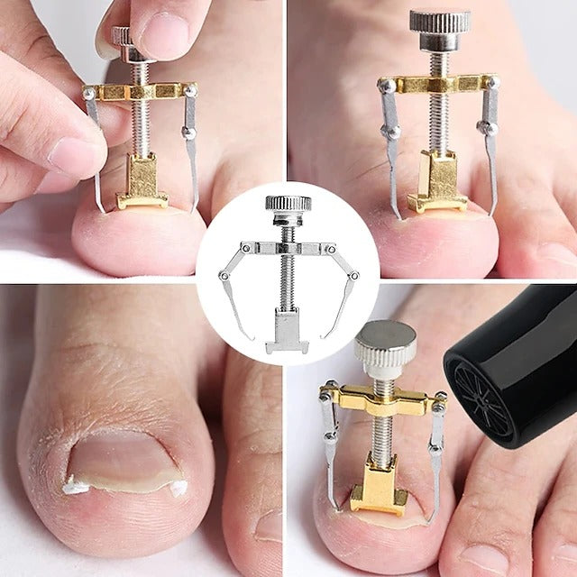 Ingrown Toenail Corrector Tool Stainless Steel Pedicure Care