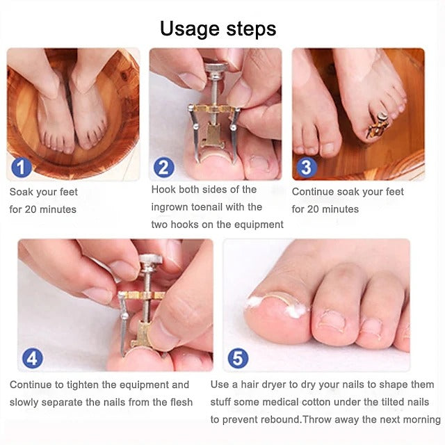 Ingrown Toenail Corrector Tool Stainless Steel Pedicure Care