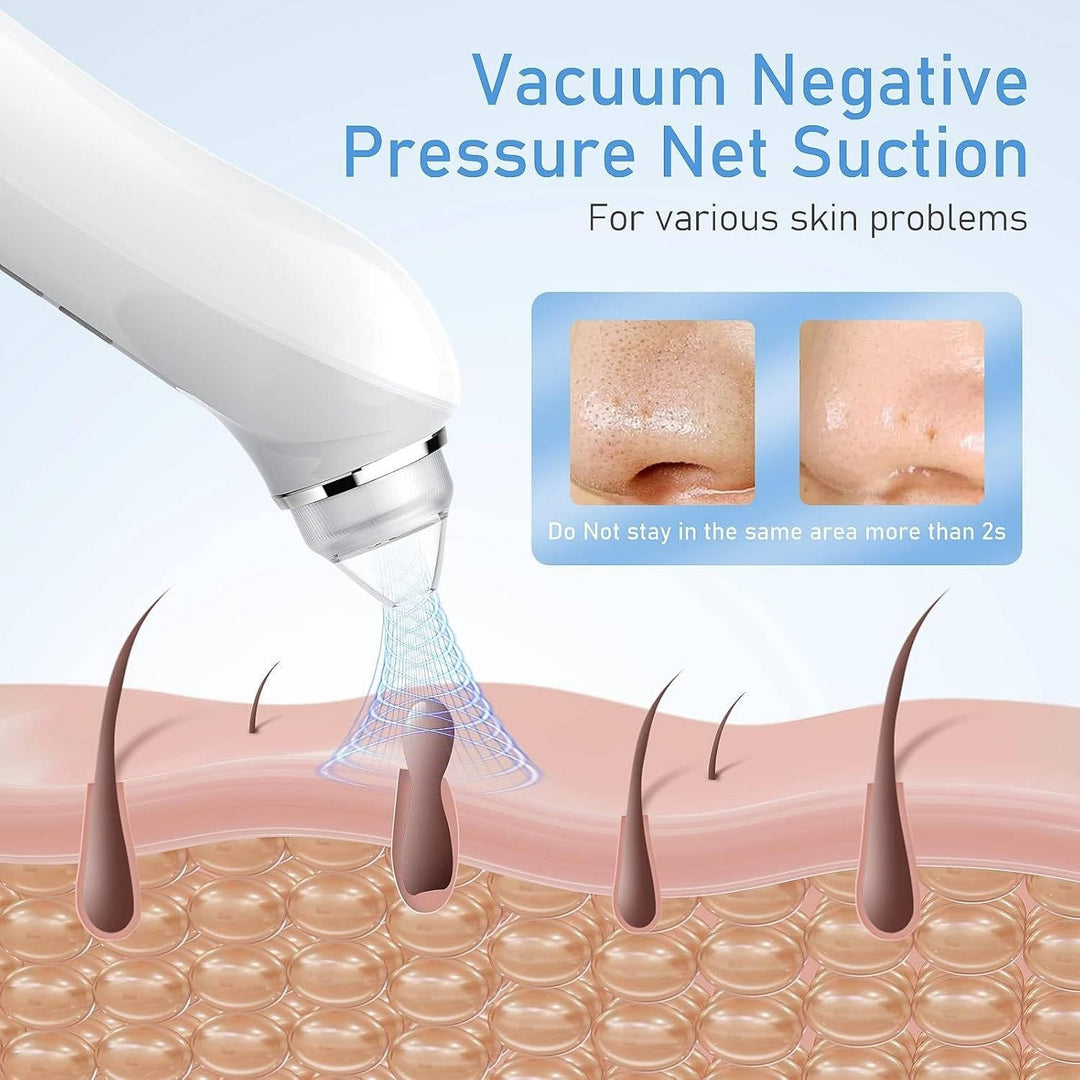 Blackhead Remover Vacuum with Camera USB Interface Pore
